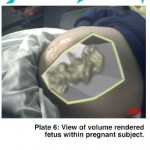 Case Study Observing a Volume Rendered Fetus within a Pregnant Patient image